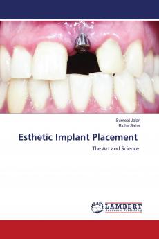 Esthetic Implant Placement