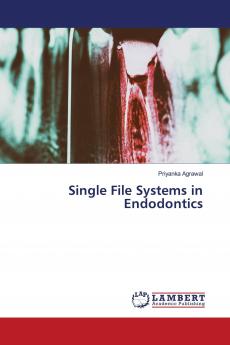 Single File Systems in Endodontics