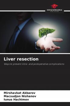 Liver resection