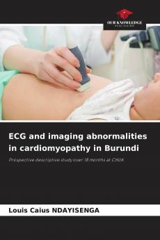 ECG and imaging abnormalities in cardiomyopathy in Burundi
