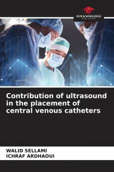 Contribution of ultrasound in the placement of central venous catheters
