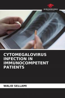 CYTOMEGALOVIRUS INFECTION IN IMMUNOCOMPETENT PATIENTS