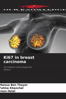Ki67 in breast carcinoma