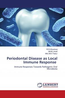 Periodontal Disease as Local Immune Response