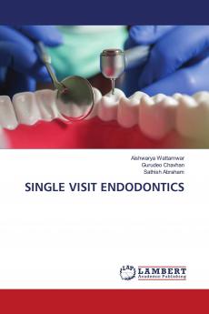 SINGLE VISIT ENDODONTICS