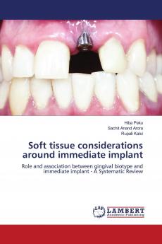 Soft tissue considerations around immediate implant