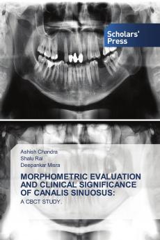 MORPHOMETRIC EVALUATION AND CLINICAL SIGNIFICANCE OF CANALIS SINUOSUS