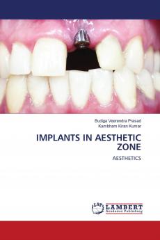 IMPLANTS IN AESTHETIC ZONE