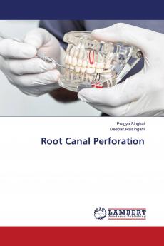 Root Canal Perforation