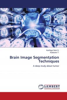 Brain Image Segmentation Techniques