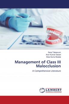 Management of Class III Malocclusion