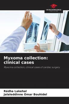 Myxoma collection
