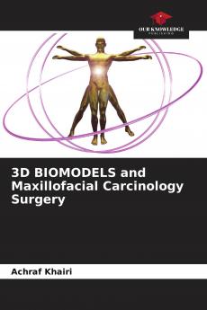 3D BIOMODELS and Maxillofacial Carcinology Surgery