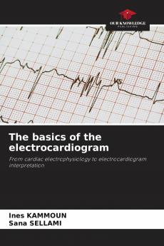 The basics of the electrocardiogram