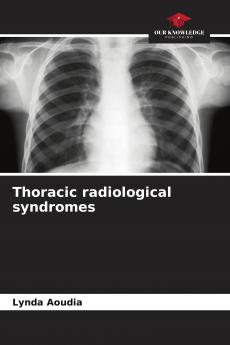 Thoracic radiological syndromes