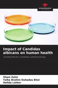 Impact of Candidas albicans on human health