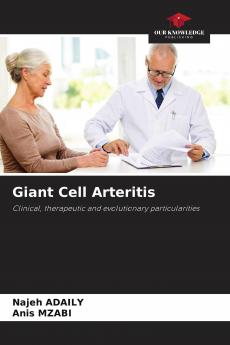 Giant Cell Arteritis