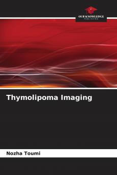 Thymolipoma Imaging