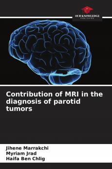 Contribution of MRI in the diagnosis of parotid tumors