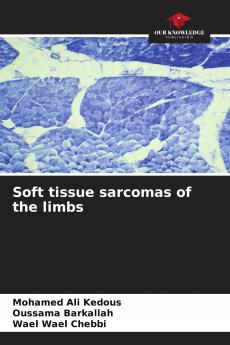 Soft tissue sarcomas of the limbs
