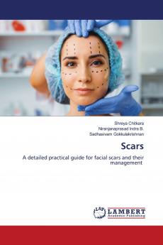 Scars