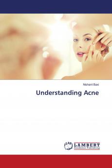 Understanding Acne