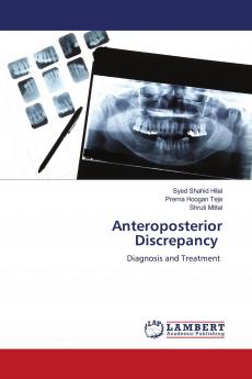 Anteroposterior Discrepancy