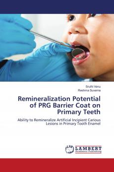 Remineralization Potential of PRG Barrier Coat on Primary Teeth