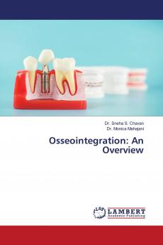 Osseointegration