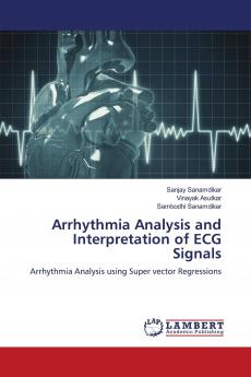 Arrhythmia Analysis and Interpretation of ECG Signals