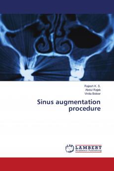Sinus augmentation procedure