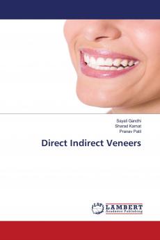 Direct Indirect Veneers