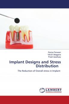 Implant Designs and Stress Distribution