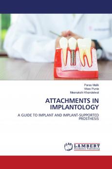 ATTACHMENTS IN IMPLANTOLOGY