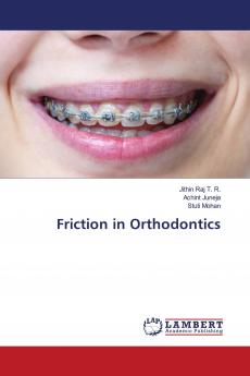 Friction in Orthodontics