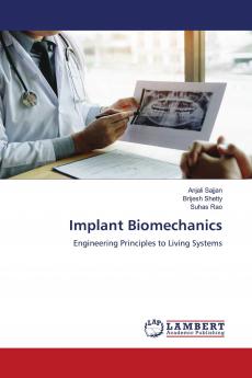 Implant Biomechanics