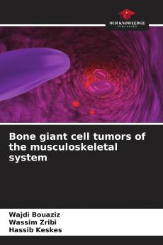 Bone giant cell tumors of the musculoskeletal system