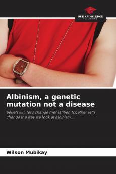 Albinism a genetic mutation not a disease