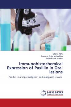 Immunohistochemical Expression of Paxillin in Oral lesions