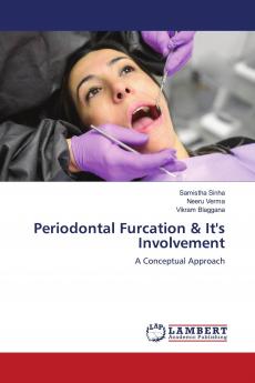 Periodontal Furcation & It's Involvement