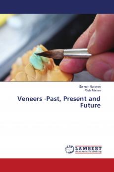 Veneers -Past Present and Future