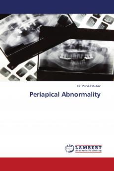 Periapical Abnormality