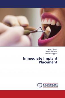 Immediate Implant Placement