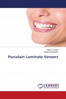 Porcelain Laminate Veneers