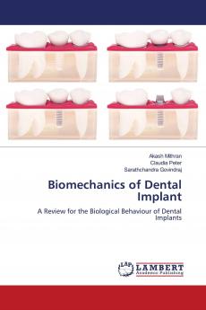 Biomechanics of Dental Implant
