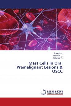 Mast Cells in Oral Premalignant Lesions & OSCC