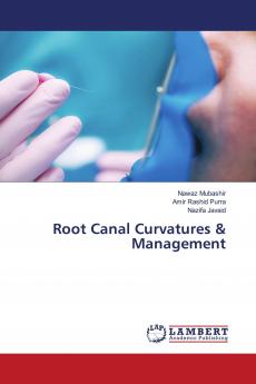 Root Canal Curvatures & Management