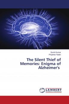 The Silent Thief of Memories
