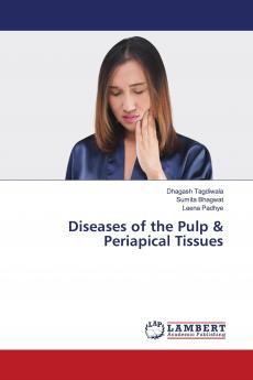 Diseases of the Pulp & Periapical Tissues