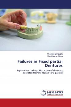 Failures in Fixed partial Dentures